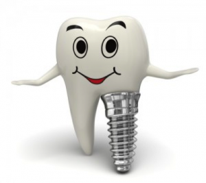 Dental Implant