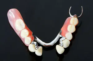 Partial denture