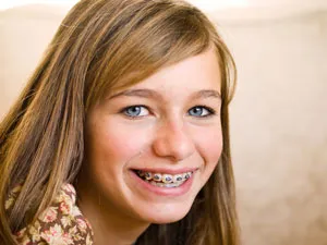 a girl with braces