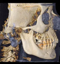 radiograph of a skull