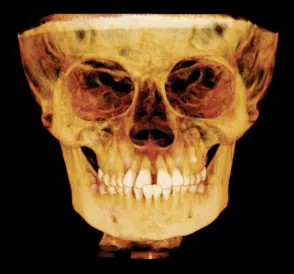 Radiograph of a skull