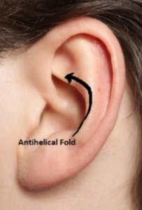 sample of antihelical fold