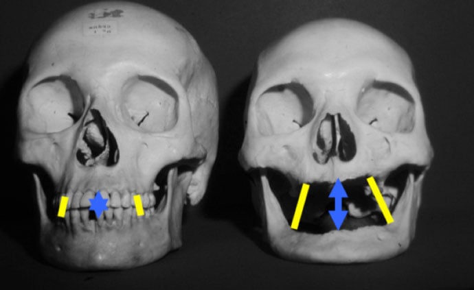 Skull