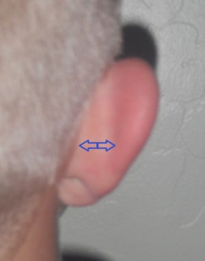 back of ears