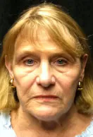 middle age woman