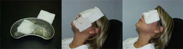 A woman using an icepack on her eyes after surgery